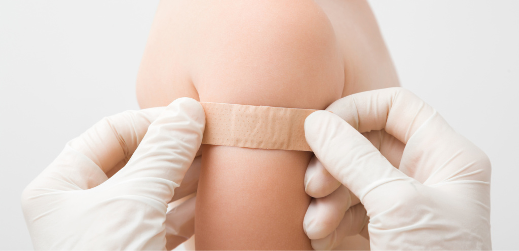 Вакцинация ребёнка в 2 года: нанесение пластыря после прививки — календарь прививок